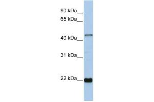WB Suggested Anti-ZNF581 Antibody Titration:  0.