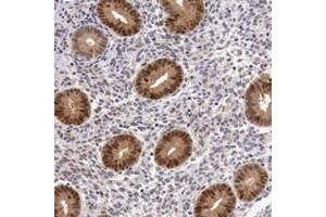 Immunohistochemical staining of human corpus, uterine with FAM122B polyclonal antibody  shows nuclear and cytoplasmic positivity in glandular cells at 1:200-1:500 dilution. (FAM122B antibody  (AA 11-132))
