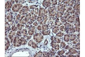 Image no. 2 for anti-Melan A (MLANA) antibody (ABIN1499423) (MLANA antibody)