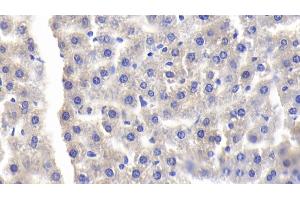 Immunohistochemistry (IHC) image for anti-Lipopolysaccharide Binding Protein (LBP) (AA 226-480) antibody (ABIN7433612)