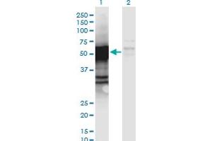 Western Blot analysis of PGCP expression in transfected 293T cell line by PGCP monoclonal antibody (M06), clone 2F7. (CPQ antibody  (AA 1-472))