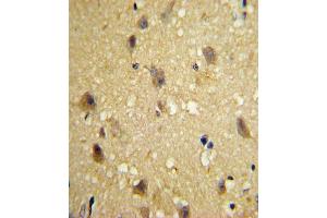 Formalin-fixed and paraffin-embedded human brain tissue with CCL2 Antibody (C-term), which was peroxidase-conjugated to the secondary antibody, followed by DAB staining. (CCL2 antibody  (C-Term))