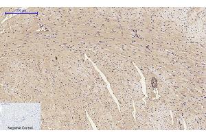 Immunohistochemical analysis of paraffin-embedded mouse heart tissue. (alpha-SMA (AA 171-220) antibody)