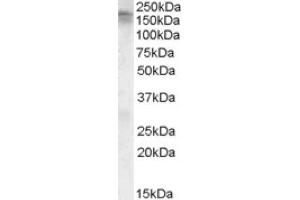 Image no. 1 for anti-Calcium Channel, Voltage-Dependent, L Type, alpha 1C Subunit (CACNA1C) (C-Term) antibody (ABIN375180)