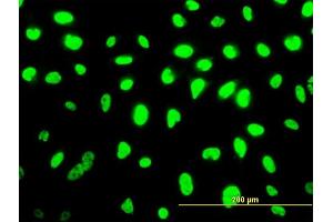 Immunofluorescence of monoclonal antibody to SMU1 on HeLa cell. (SMU1 antibody  (AA 1-513))