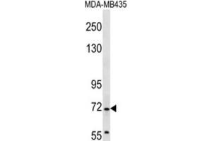 Western Blotting (WB) image for anti-Grainyhead-Like 2 (GRHL2) antibody (ABIN2997171) (GRHL2 antibody)