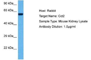 Host: Mouse Target Name: CCT2 Sample Tissue: Mouse Kidney Antibody Dilution: 1ug/ml (CCT2 antibody  (Middle Region))