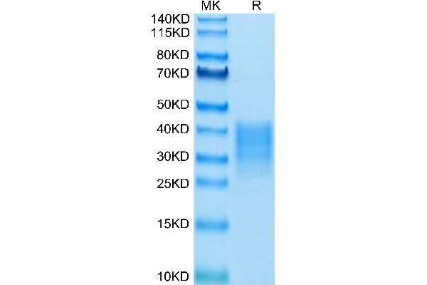 FAS Protein (AA 26-173) (His tag)