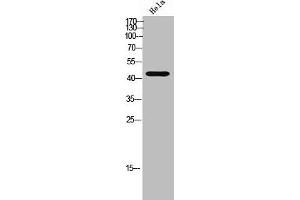 Western Blot analysis of HeLa cells using mAChR M2 Polyclonal Antibody (Muscarinic Acetylcholine Receptor M2 antibody  (Internal Region))