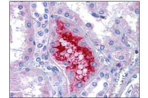 Human Kidney: Formalin-Fixed, Paraffin-Embedded (FFPE) (MATN1 antibody  (C-Term))