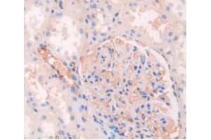 IHC-P analysis of Human Kidney Tissue, with DAB staining. (Rabbit anti-Human IgG4 (AA 222-327) Antibody)