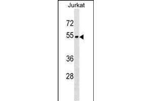 ZN Antibody (Center) (ABIN1538123 and ABIN2849842) western blot analysis in Jurkat cell line lysates (35 μg/lane). (ZNF703 antibody  (AA 226-254))