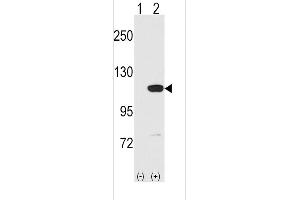 Western blot analysis of MVP using rabbit polyclonal MVP C-term Antibody using 293 cell lysates (2 ug/lane) either nontransfected (Lane 1) or transiently transfected with the MVP gene (Lane 2). (MVP antibody  (C-Term))