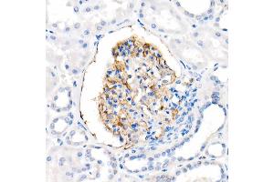 Immunohistochemistry of paraffin-embedded Human kidney using CD35/CR1 antibody (ABIN7266477) at dilution of 50 (40x lens). (CD35 antibody)