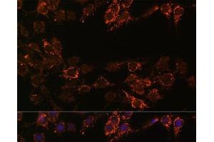 Immunofluorescence analysis of C6 cells using MAOA Polyclonal Antibody at dilution of 1:100. (Monoamine Oxidase A antibody)