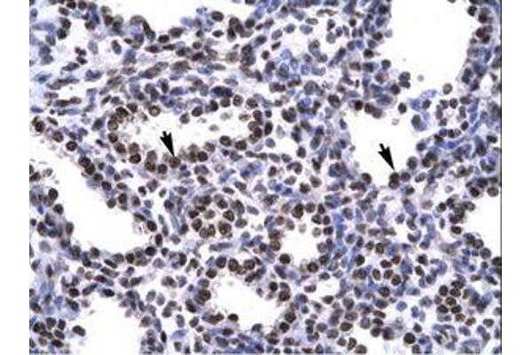 BARHL2 antibody  (AA 165-214)
