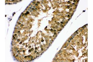 Anti- PDPK1 Picoband antibody, IHC(P) IHC(P): Rat Testis Tissue (PDPK1 antibody  (C-Term))