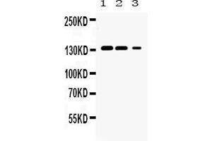 Western blot analysis of JAK1 expression in rat kidney extract ( Lane 1), mouse kidney extract ( Lane 2) and HELA whole cell lysates ( Lane 3). (JAK1 antibody  (N-Term))