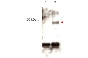 Image no. 1 for anti-Signal Transducer and Activator of Transcription 1, 91kDa (STAT1) (pTyr701) antibody (ABIN401047)