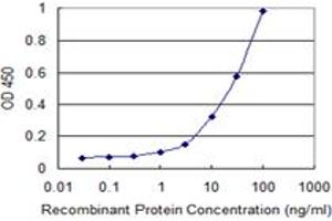 Detection limit for recombinant GST tagged STIM1 is 0. (STIM1 antibody  (AA 24-685))