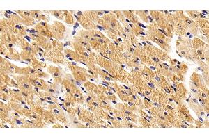Detection of TLR2 in Porcine Cardiac Muscle Tissue using Polyclonal Antibody to Toll Like Receptor 2 (TLR2) (TLR2 antibody  (AA 47-245))
