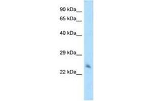 Image no. 1 for anti-Hippocalcin-Like 1 (HPCAL1) (AA 105-154) antibody (ABIN6748027) (HPCAL1 antibody  (AA 105-154))