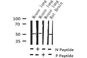 RUNX1 antibody  (pSer304)