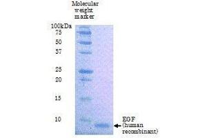 SDS-PAGE (SDS) image for Epidermal Growth Factor (EGF) (Active) protein (ABIN2452188) (EGF Protein)