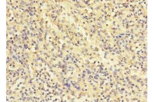 Immunohistochemistry of paraffin-embedded human spleen tissue using ABIN7174246 at dilution of 1:100 (COQ4 antibody  (AA 31-265))