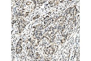 IHC analysis of C-Jun/JUN using anti-C-Jun/JUN antibody (ABIN7601421). (C-JUN antibody  (AA 35-331))