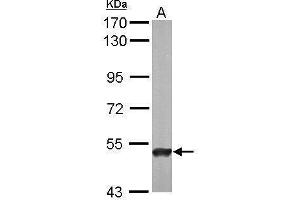 WB Image Sample (50 ug of whole cell lysate) A: Mouse brain 7. (ABAT antibody  (C-Term))