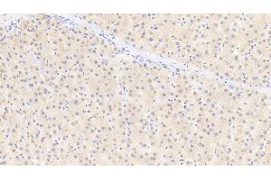 Detection of GSTa1 in Human Liver Tissue using Polyclonal Antibody to Glutathione S Transferase Alpha 1 (GSTa1) (GSTA1 antibody  (AA 2-222))