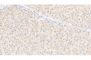 Detection of GSTa1 in Human Liver Tissue using Polyclonal Antibody to Glutathione S Transferase Alpha 1 (GSTa1) (GSTA1 antibody  (AA 2-222))