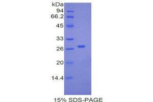 SDS-PAGE (SDS) image for alpha-2-HS-Glycoprotein (AHSG) (AA 19-250) protein (His tag) (ABIN2120511)