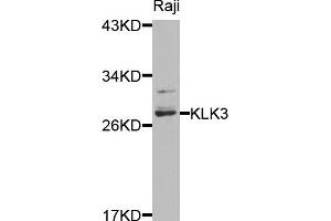 Western blot analysis of extracts of raji cells, using KLK3 antibody. (Prostate Specific Antigen antibody)