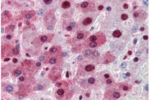 Human Liver (formalin-fixed, paraffin-embedded) stained with NPM1 antibody ABIN364324 at 5 ug/ml followed by biotinylated anti-mouse IgG secondary antibody ABIN481714, alkaline phosphatase-streptavidin and chromogen. (NPM1 antibody  (AA 81-294))
