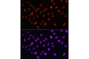 Immunofluorescence analysis of U2OS cells using MonoMethyl-Histone H3-K9 Rabbit mAb (ABIN7267685) at dilution of 1:100 (40x lens). (Histone 3 antibody  (H3K9me))