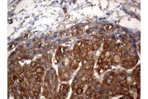 Image no. 1 for anti-3-Oxoacyl-ACP Synthase, Mitochondrial (OXSM) (AA 78-343) antibody (ABIN1491676) (OXSM antibody  (AA 78-343))