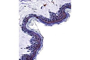 Tyrosinase Antibody (C-term) ((ABIN391520 and ABIN2841480))immunohistochemistry analysis in formalin fixed and paraffin embedded human skin tissue followed by peroxidase conjugation of the secondary antibody and DAB staining. (TYR antibody  (C-Term))