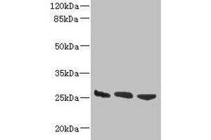 Western blot All lanes: DNAJB8 antibody at 8 μg/mL Lane 1: Hela whole cell lysate Lane 2: Mouse brain tissue Lane 3: Mouse liver tissue Secondary Goat polyclonal to rabbit IgG at 1/10000 dilution Predicted band size: 26 kDa Observed band size: 26 kDa (DNAJB8 antibody  (AA 1-232))