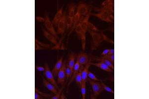 Immunofluorescence analysis of NIH/3T3 cells using NUMB Rabbit pAb (ABIN6129424, ABIN6144943, ABIN6144944 and ABIN6224990) at dilution of 1:250 (40x lens). (NUMB antibody  (AA 521-640))