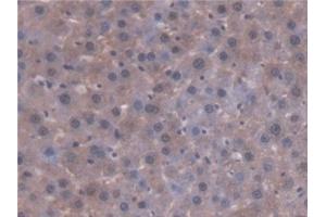 Detection of AT in Rat Liver Tissue using Polyclonal Antibody to Antithrombin (AT) (SERPINC1 antibody  (AA 33-465))