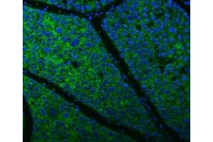 IF analysis of Citrin/SLC25A13 using anti-Citrin/SLC25A13 antibody (ABIN7599512). (slc25a13 antibody  (AA 1-643))