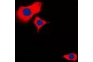 Immunofluorescent analysis of HSPB2 staining in Hela cells.
