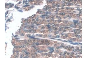 Detection of GPX3 in Mouse Stomach Tissue using Polyclonal Antibody to Glutathione Peroxidase 3, Plasma (GPX3) (GPX3 antibody  (AA 3-72))