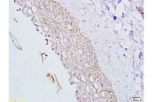 Formalin-fixed and paraffin embedded rat ovary tissue labeled with Anti-Inhibin Alpha Polyclonal Antibody, Unconjugated  at 1:200, followed by conjugation to the secondary antibody and DAB staining (Inhibin alpha antibody  (AA 301-366))