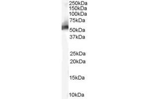 Image no. 2 for anti-Mdm2, p53 E3 Ubiquitin Protein Ligase Homolog (Mouse) (MDM2) (Internal Region) antibody (ABIN185508)