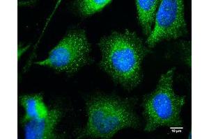 ICC/IF Image Bif-1 antibody [C2C3], C-term detects Bif-1 protein at cytoplasm by immunofluorescent analysis.
