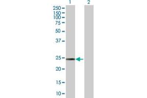 Western Blot analysis of ARHGDIB expression in transfected 293T cell line by ARHGDIB MaxPab polyclonal antibody.
