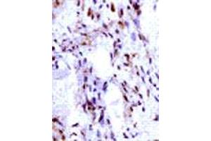 Immunohistochemical analysis of IGF2 expression in human ovarian vascular endothelial cells. (IGF2 antibody  (C-Term))